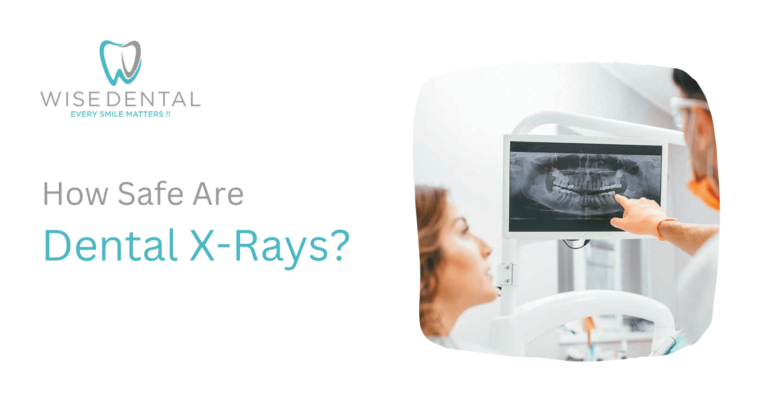 How Safe Are Dental X Rays Wise Dental