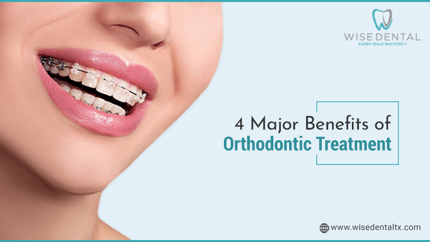 4 Major Benefits of Orthodontic Treatment