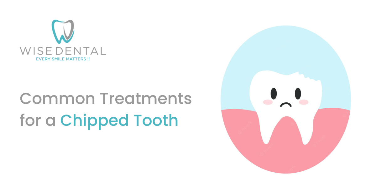 Common Treatments for a Chipped Tooth