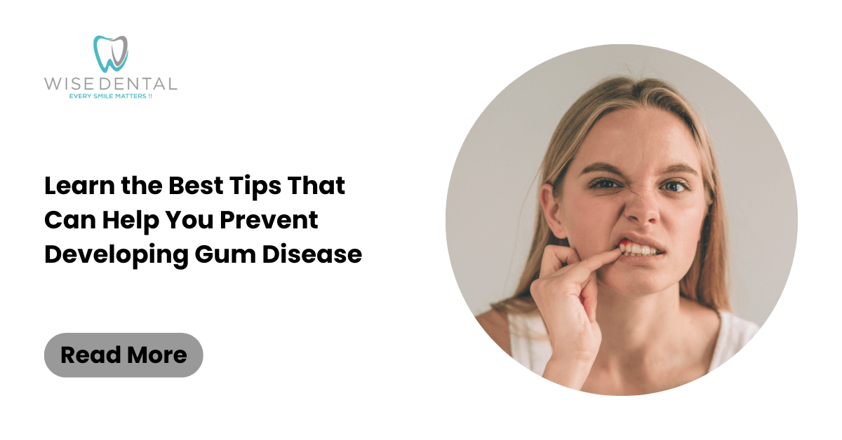 Learn the Best Tips That Can Help You Prevent Developing Gum Disease